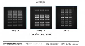 瓊脂糖預(yù)染預(yù)制膠電泳試劑盒