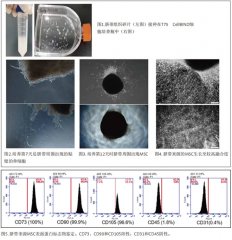 分離及培養(yǎng)臍帶來(lái)源間 充質(zhì)干細(xì)胞